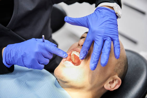 Best Knocked-Out Tooth (Avulsed Tooth) Treatment in Wesson, MS