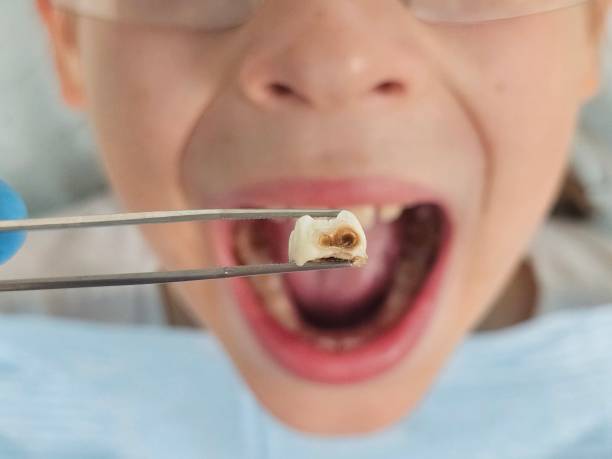  Wesson, MS Emergency Dentist Pros